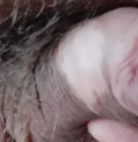 pata vitiligo