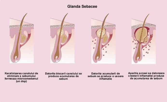 Glanda Sebacee