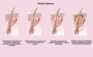 Glanda Sebacee