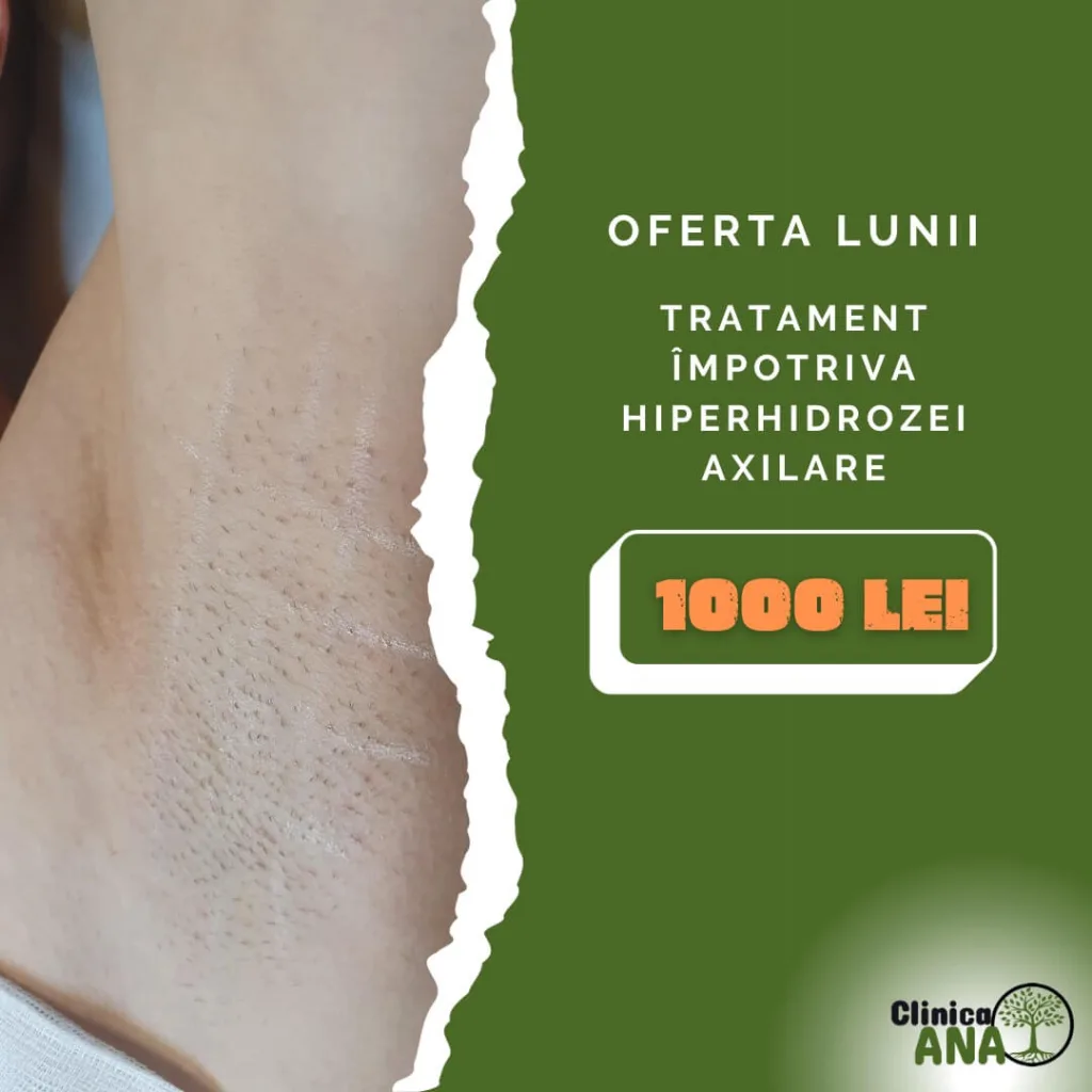 tratament transpiratie excesiva