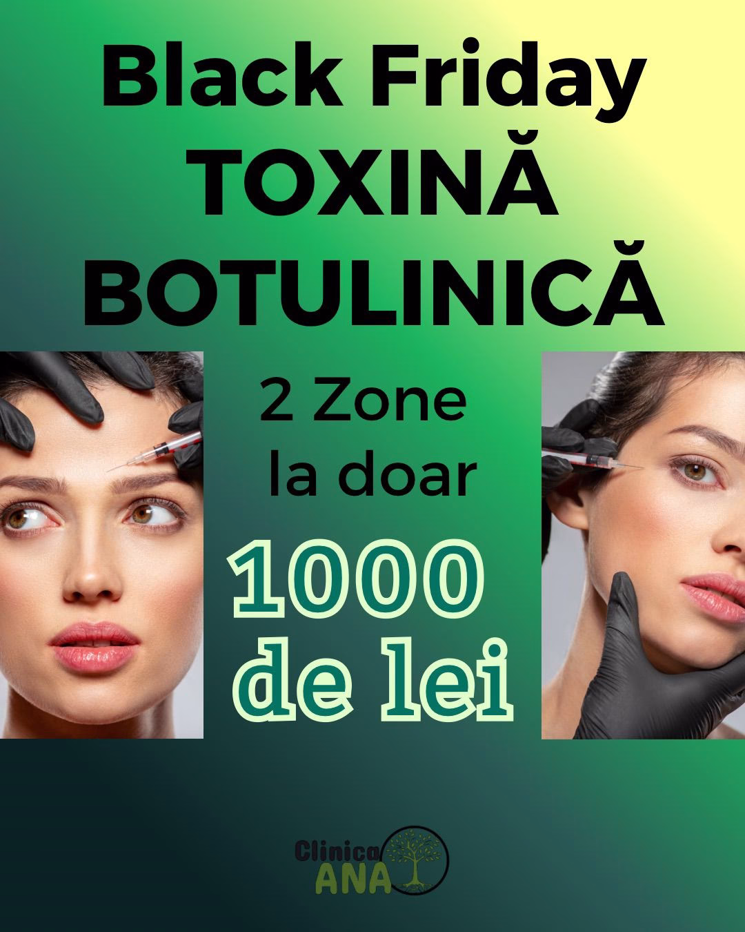 oferta toxina botulinica